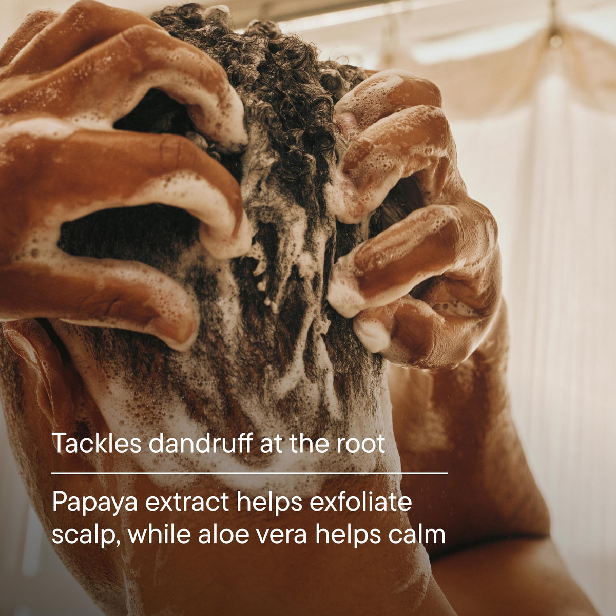 Close-up of a person's scalp with soap suds, text about dandruff treatment.